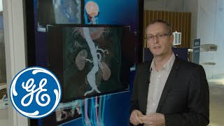 What's new with GE Healthcare - Discovery IGS 7 OR