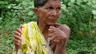 Woman born with 12 fingers, 20 toes| CCTV English