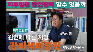 장미색 비강진  원인 및 처방