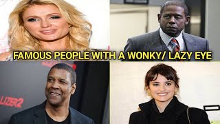 Famous people with (strabismus) lazy eye