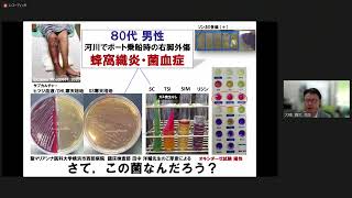 四学会合同事業 セミナー「ポストコロナのリセット戦略」その4　講演　話題の輸入感染症－病原体検出のコツ（2023年10月8日開催）