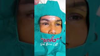 Review ยกคิ้ว Sub brow lift ความแตกต่างหลังทำทันที