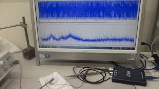 超音波の圧電素子を調整する技術を開発－－超音波の伝搬特性を測定・解析・評価する技術の応用－－（超音波システム研究所）