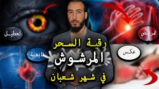 أقوى رقية لإخراج السحر المرشوش والتخلص منه ومن عقده القوية والمؤلمة في الساقين والأرجل