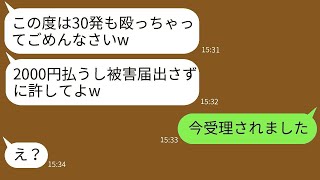 帰宅すると、見知らぬ女性たちに待ち伏せされ、顔を30回も殴られた。「この泥棒猫！」という理由で殴られた私の悲惨な状況と、その女性たちの末路…