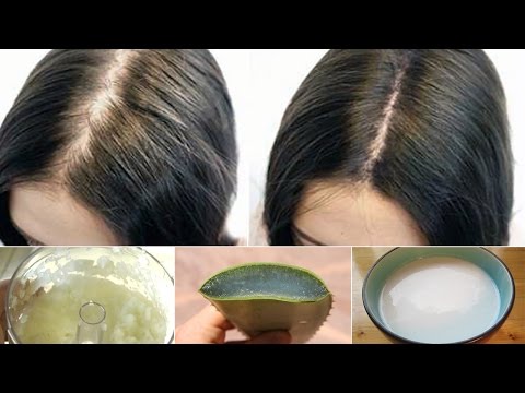 6 Proven Home Remedies for Hair Loss 6 Proven Home Remedies for Hair Loss
