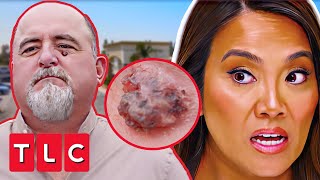 Dr Lee Thinks This Patient's Pimple Could Be SKIN CANCER | Dr. Pimple Popper