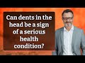 Can dents in the head be a sign of a serious health condition?