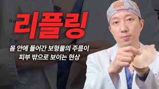 가슴성형을 했거나 할 사람들은 필수로 시청합니다  [가슴수술,가슴확대,리플링현상]