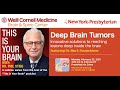 This Is Your Brain: Deep Brain Tumors, featuring Dr. Mark Souweidane