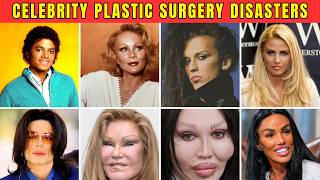 40 Celebrity Plastic Surgery Disasters | Before and After