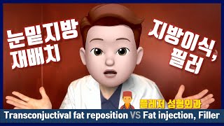 눈밑지방재배치가 나을까, 지방이식 필러가 나을까? - 나에게 맞는 수술/시술은?