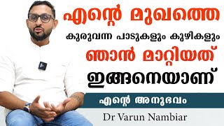 മുഖത്തെ എത്ര പഴകിയ കുഴികളും പാടുകളും മാറി മുഖം വെളുക്കും ഇങ്ങനെ ചെയ്താൽ Dr Varun Nambiar#velukkan