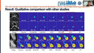 [CVPR 2023] SDC-UDA (8-Min Presentation Video)