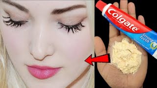 Permanent Skin Whitening Remedy|టొమాటో తో ఇలా చేస్తే 7 రోజుల్లో మీ చర్మం శాశ్వతంగా తెల్లగా మారుతుంది