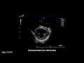 bpl alpinion e cube 7 cardiac ultrasound