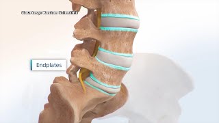 Boston Scientific Develops Procedure for Chronic Back Pain