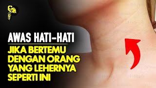 SUNGGUH MENGERIKAN ⚠️ 10 Kelebihan Spiritual Pemilik Garis Leher dalam Spiritual