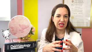 Do Food Allergies Cause Eczema? A Dermatologist Explains - Dr. Heidi Goodarzi