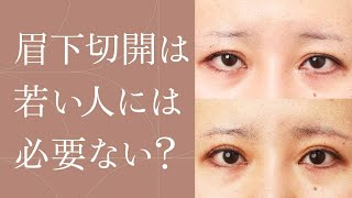 【眉下切開】手術を受ける年齢と適応のある人について【二重整形】