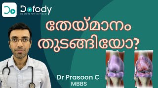 തേയ്മാനത്തിന്റെ ലക്ഷണം എന്താണ്? 🦶 ഓസ്റ്റിയോ ആർത്രൈറ്റിസിന്റെ ഈ ലക്ഷണങ്ങൾ നിങ്ങൾക്കുണ്ടോ? 🩺