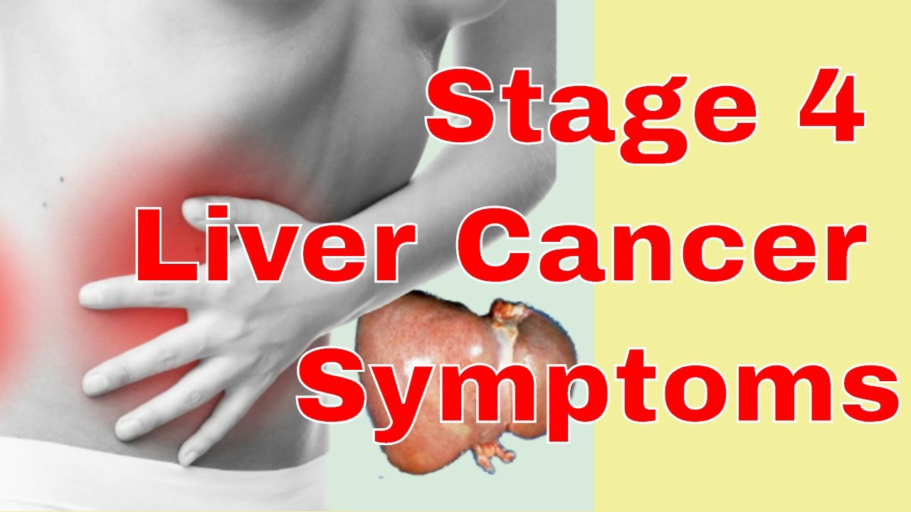 Stage 4 Liver Cancer Symptoms - YouTube