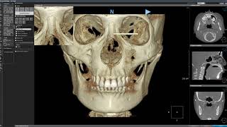 3D Ceph compare