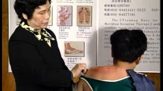 7 Gua sha for Periarthritis of the Shoulder