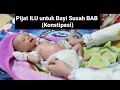 Cara mengatasi sembelit pada bayi dan tutorial Pijat ILU Untuk bayi susah BAB (KONSTIPASI)