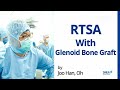 [LIVE] Reverse Total Shoulder Arthroplasty Surgery with glenoid bone graft