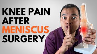 Top 9 Secret Reasons For Knee Pain 3 Months Or More After Meniscus Surgery