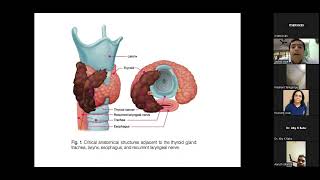 Tracheal resection for Thyroid cancers- Dr Snehal shah