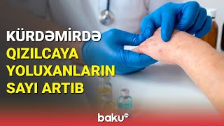 Kürdəmirdə 7 məktəbdə şagirdlər arasında qızılca yayılıb