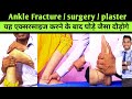 best ankle rehabilitation exercises, ankle exercises after surgery,  ankle fracture, ankle mobility