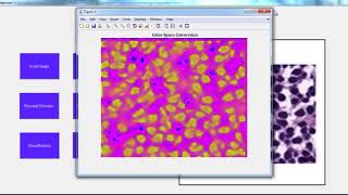 Final Year Ece Projects Based on Image Processing | Final Year Ece Thesis Based on Image Processing