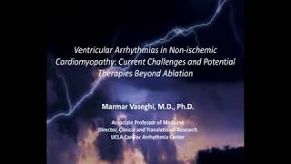 Ventricular Arrhythmias in Non-ischemic Cardiomyopathy March 8 2019