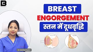 Breast Engorgement in Hindi | स्तन में दूधवृद्धि - Cause & Treatment | स्तनपान के दौरान दर्द #women