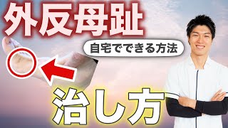 【外反母趾の治し方】自宅でもできる方法　｜奈良県桜井市「たに整体院」