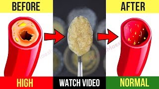 This Mixture Will Unclog Arteries Naturally And Control High Blood Pressure