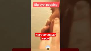 pimple popping 2022 new  blackheads #whiteheads   #acnetreatment #shorts  #cyst #extractions