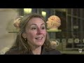 Brain Tumor Treatment – Radiosurgery