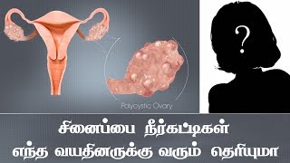 சினைப்பை நீர்க்கட்டிகள் எந்த வயதினருக்கு வரும் | Cyst Come At Which Age | Detailed Explain | Siddha