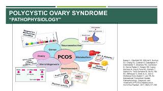 PCOS lecture