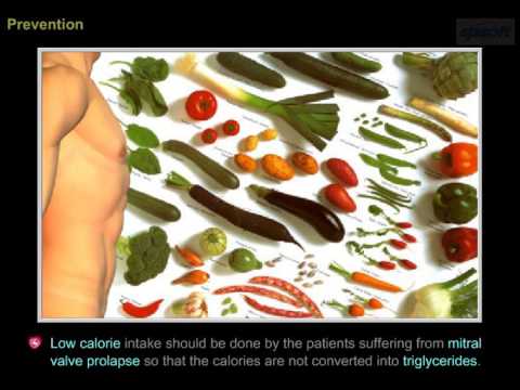 How to Prevent Mitral Valve Prolapse How to Prevent Mitral Valve Prolapse