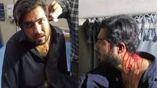 News: Iqrar Ul Hassan Got Attacked and Injured | Journalist Iqrar ul Hassan Sar e Aam Team
