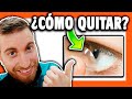 ✅ ¿Cómo QUITARSE las LENTILLAS? ➡️ Truco [Rápido y seguro]