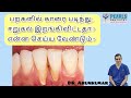 Got car stains on your teeth and tartar? What to do? Dr. Arunkumar | Pearls Dentistry