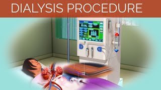 Dialysis Procedure | Hemodialysis & Peritoneal Dialysis | Dialysis Animation