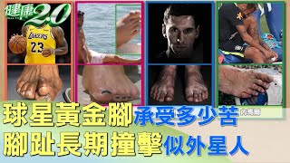 球星黃金腳承受多少苦 腳趾長期撞擊似外星人 健康2.0