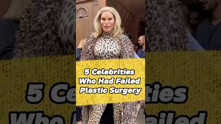 5 celebrities who had failed plastic surgery #celebrities